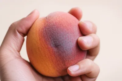 Illustration bruising - Image 1