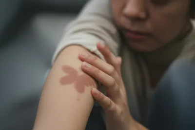 Illustration stigma - Image 1