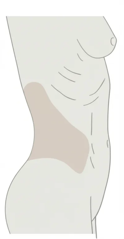 Illustration flank