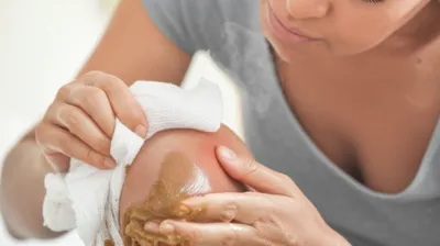 Illustration poultice