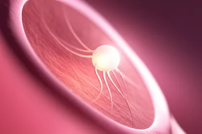 Illustration implant - Image 1