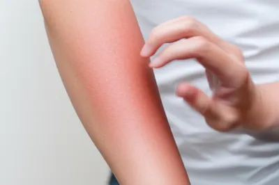 Illustration scratches - Image 1