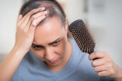 Illustration effluvium - Image 1