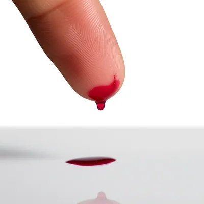 Illustration bleed - Image 1