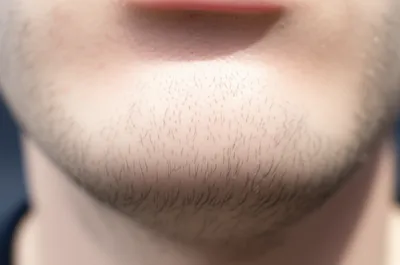 Illustration pappus - Image 1