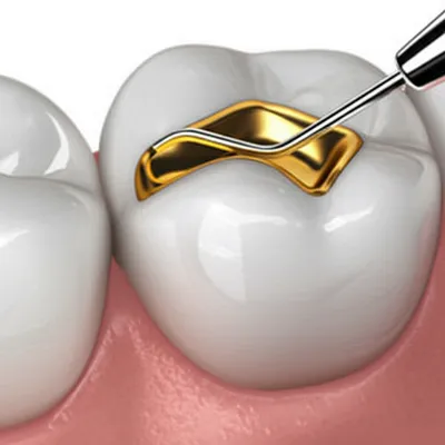 Illustration inlay - Image 1