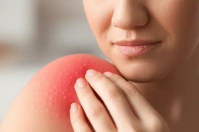 Illustration irritated - Image 1