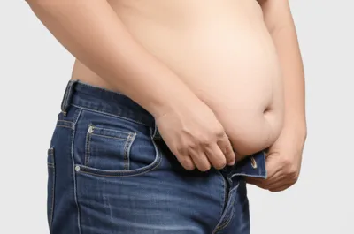 Illustration overweight - Image 1