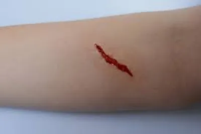 Illustration gash - Image 2