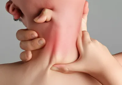 Illustration strangle - Image 1