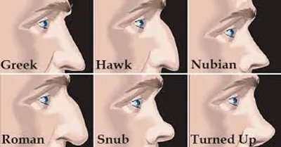 Illustration snub - Image 2