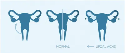 Illustration version - Image 1