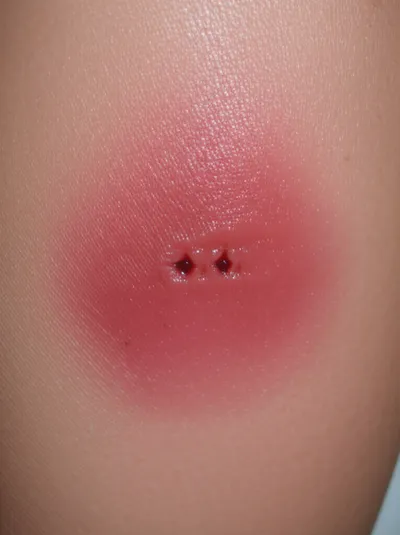 Illustration bites - Image 1