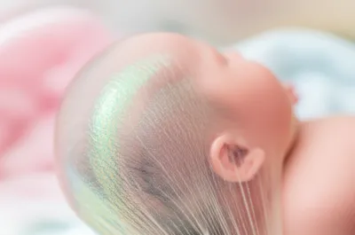 Illustration caul - Image 1