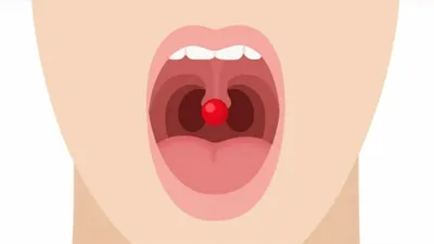 Illustration throat - Image 1