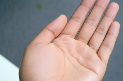 Illustration pat - Image 1