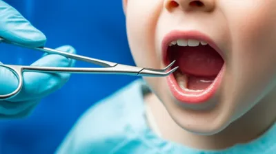 Illustration guillotines - Image 1