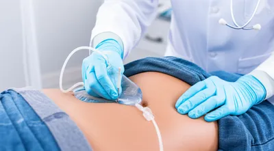 Illustration taps - Image 1