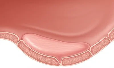 Illustration uvulas - Image 1