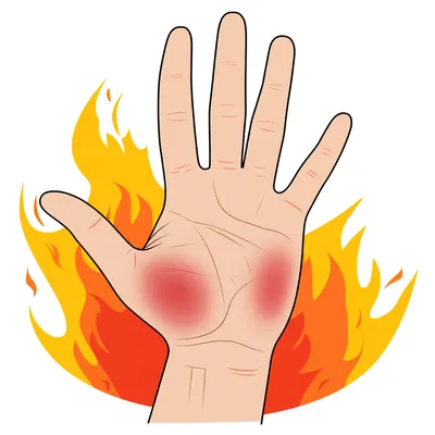 Illustration burn - Image 1
