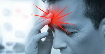 Illustration migraine