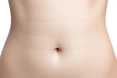 Illustration stria - Image 1