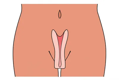 Illustration cooch - Image 1