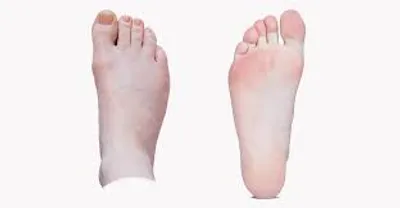 Illustration foot - Image 2