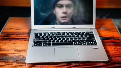 Illustration burns - Image 1