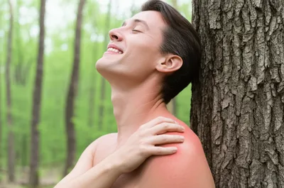 Illustration itches - Image 1