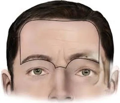 Illustration forehead - Image 2