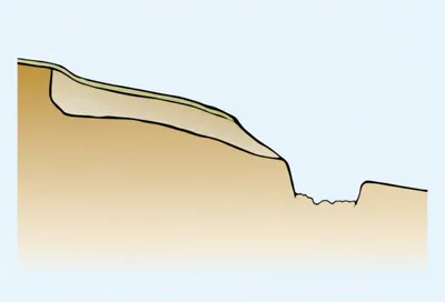 Illustration berm - Image 1