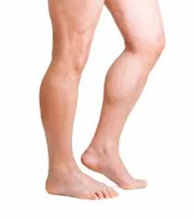 Illustration leg - Image 4