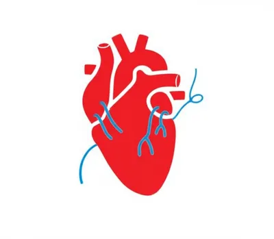 Illustration ligature - Image 1