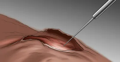 Illustration tent - Image 1