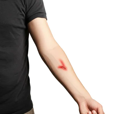 Illustration hurt - Image 1