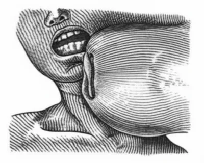 Illustration bitten - Image 1