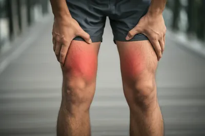 Illustration chafes - Image 1