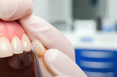 Illustration buildup - Image 1