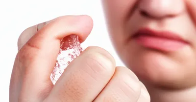 Illustration excruciatingly - Image 1