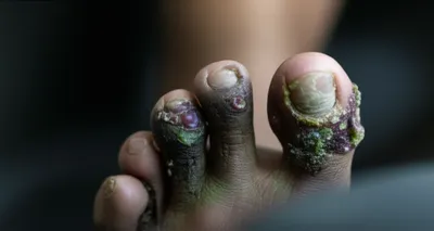 Illustration putrefied - Image 1