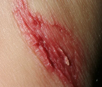 Hình ảnh minh họa raw - Ảnh 1