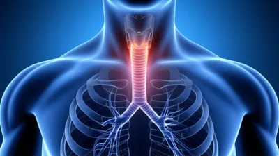 Illustration airway - Image 1