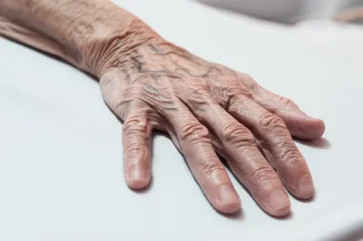 Illustration emaciated - Image 1