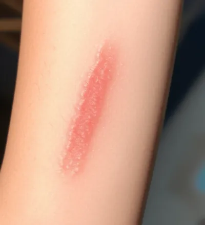 Illustration wheal - Image 1