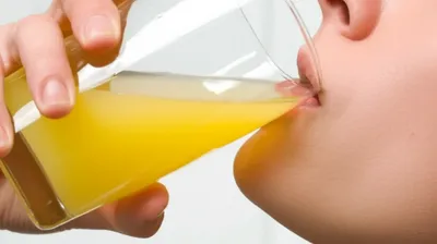 Illustration downs - Image 1