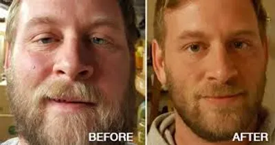 Illustration sober - Image 2