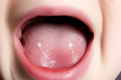 Illustration dorsum - Image 1