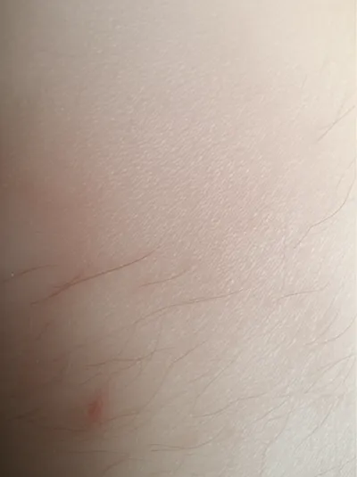 Illustration tingle - Image 1