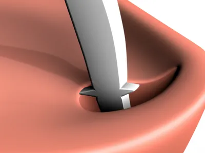 Illustration poked - Image 1